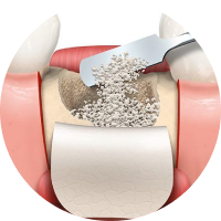 THỜI GIAN TÍCH HỢP IMPLANT