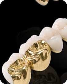 RĂNG SỨ KIM LOẠI QUÝ