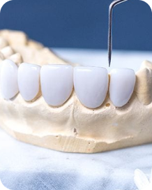 RĂNG SỨ TOÀN SỨ