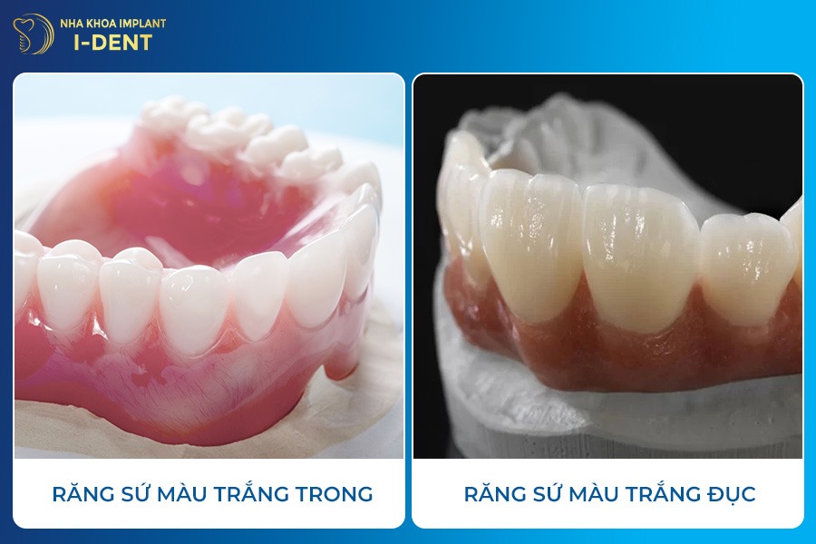 màu răng sứ tự nhiên nhất