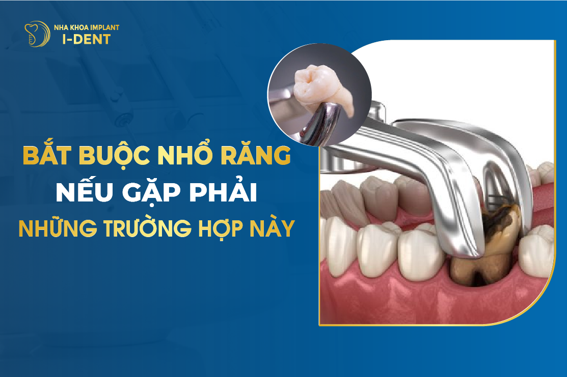 Bắt Buộc Nhổ Răng Nếu Gặp Phải Những Trường Hợp Này