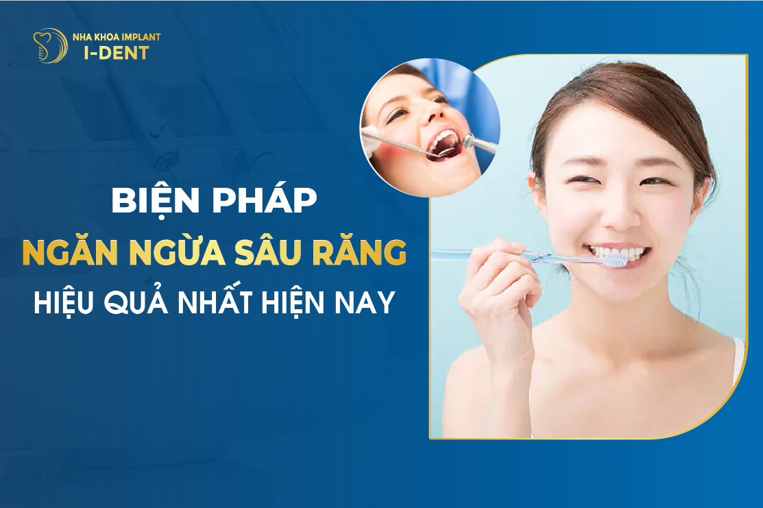 Biện Pháp Ngăn Ngừa Sâu Răng Hiệu Quả Nhất Hiện Nay