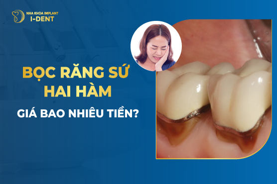 Bọc Răng Sứ Hai Hàm Giá Bao Nhiêu Tiền?
