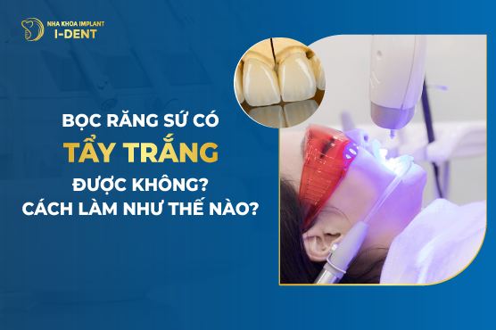 Bọc răng sứ có tẩy trắng được không?