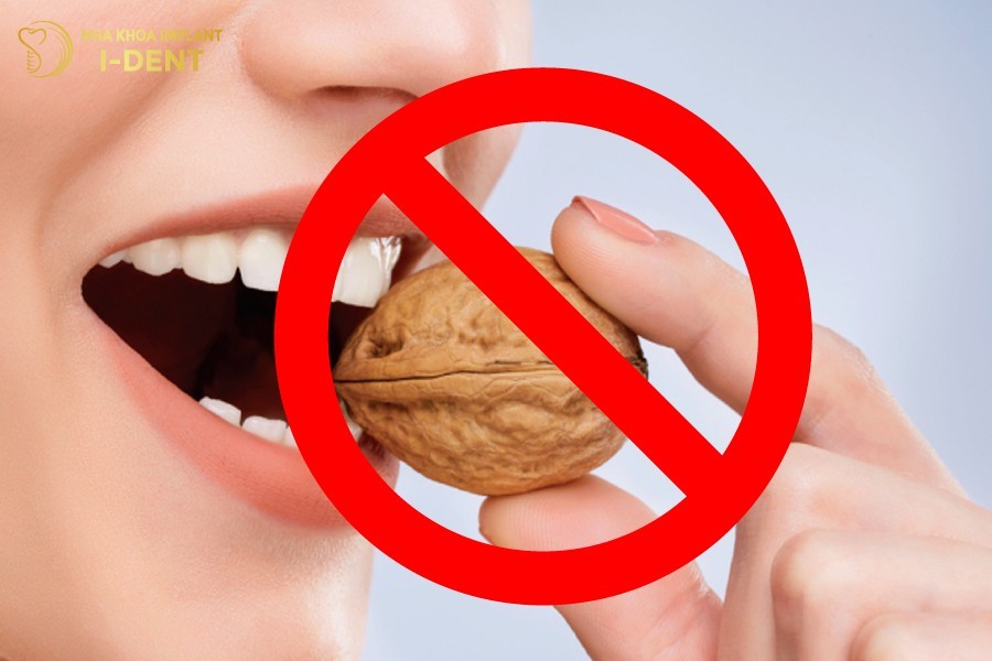 Cac-luu-y-truoc-khi-tram-rang