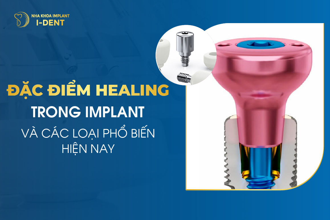 Đặc Điểm Healing Trong Implant Và Các Loại Phổ Biến Hiện Nay