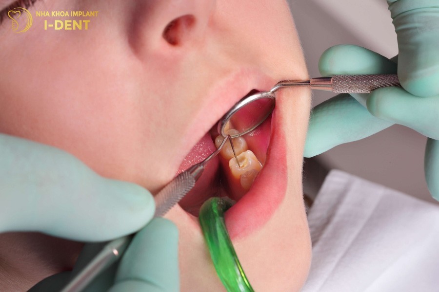 Dat-thuoc-diet-tuy-khong-dau