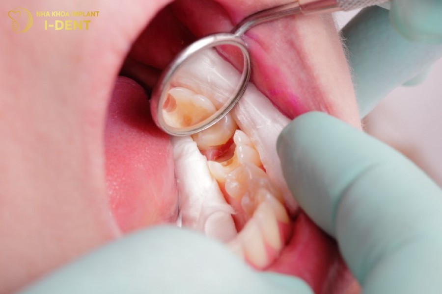 Dat-thuoc-diet-tuy-tu-1-2-ngay