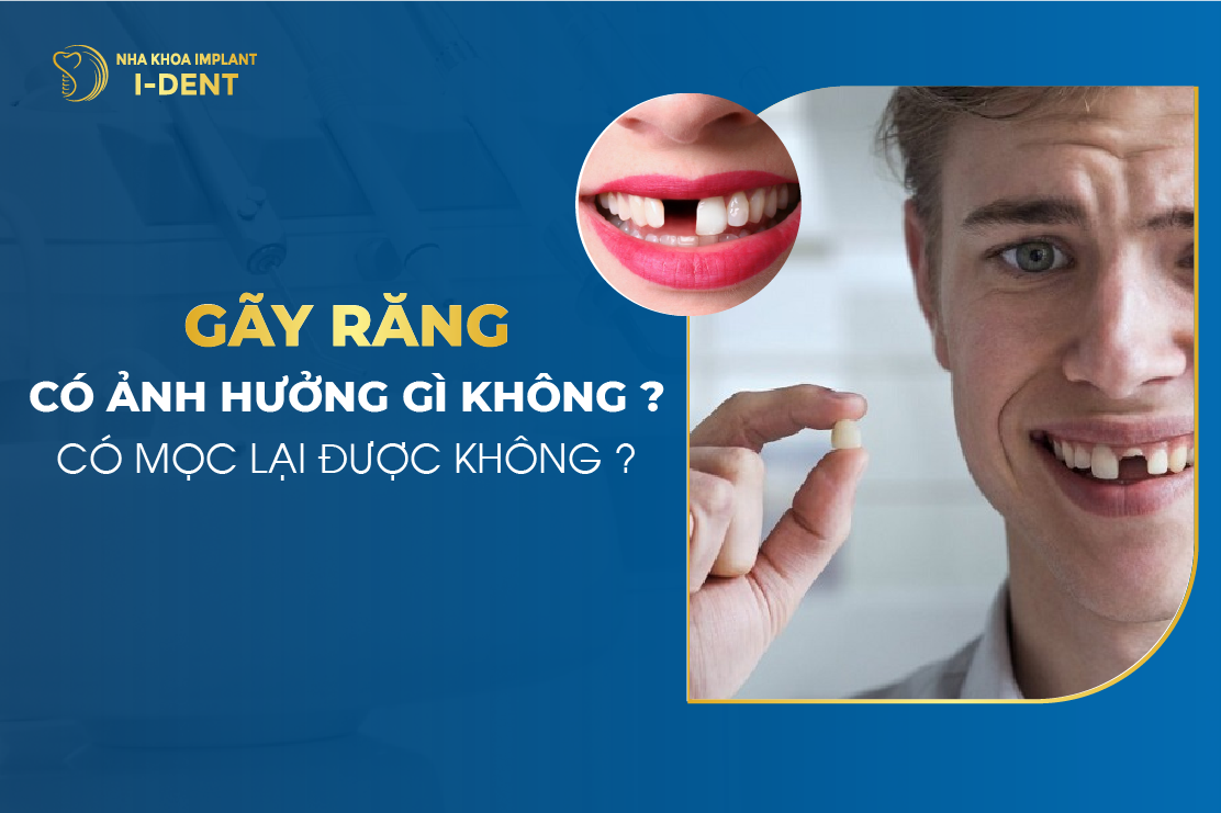 Gãy răng có sao không? Có ảnh hưởng gì không?