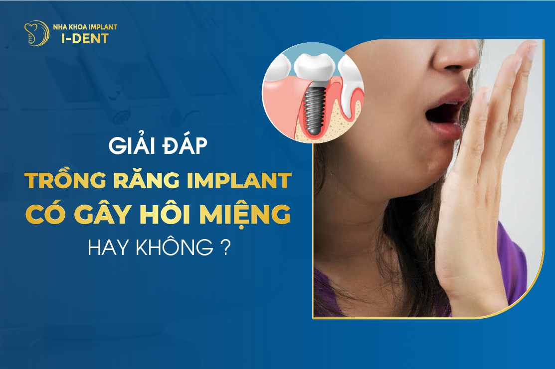 Trồng răng implant có gây hôi miệng không? Cách khắc phục