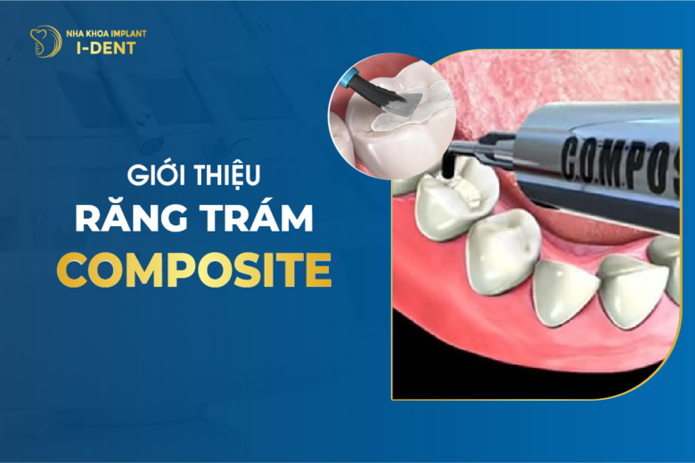 Giới Thiệu Răng Trám Composite