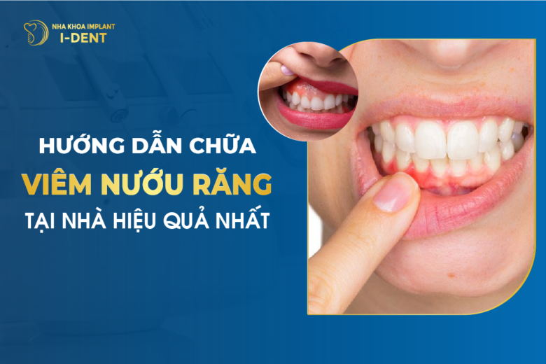 Viêm nướu làm sao hết? Dấu hiệu và cách trị viêm nướu tại nhà