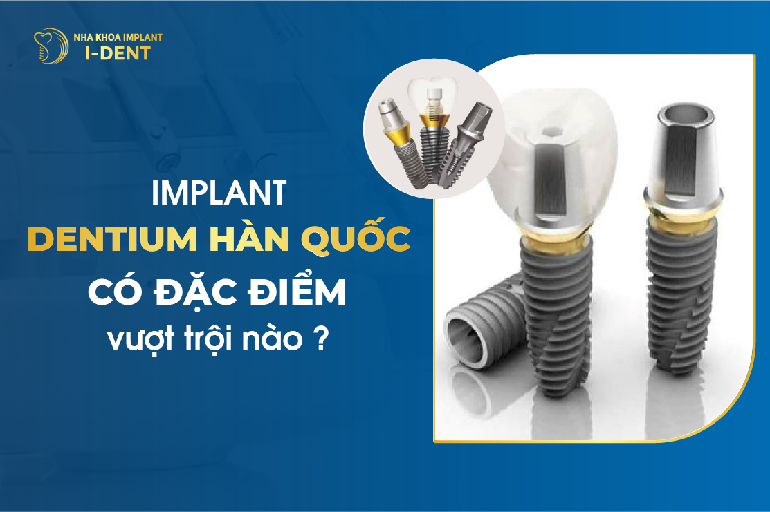 Implant Dentium Hàn Quốc: Đặc điểm, ưu điểm và chất lượng
