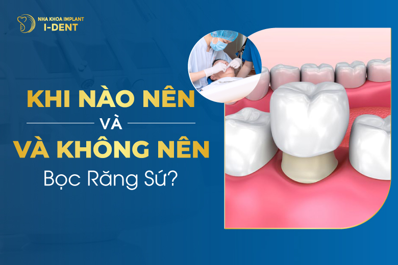Có nên làm răng sứ không? Trường hợp nào nên và không nên?