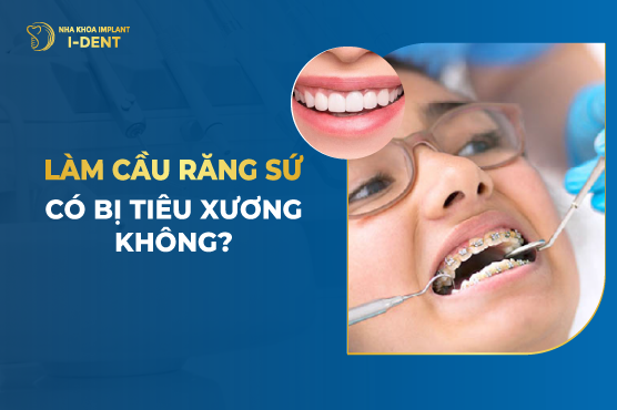 Làm Cầu Răng Sứ Có Bị Tiêu Xương Không?
