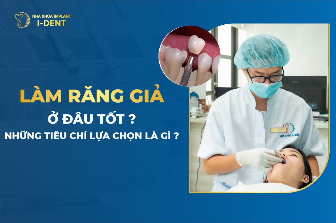 Làm Răng Giả Ở Đâu Tốt? Những Tiêu Chí Lựa Chọn Là Gì?