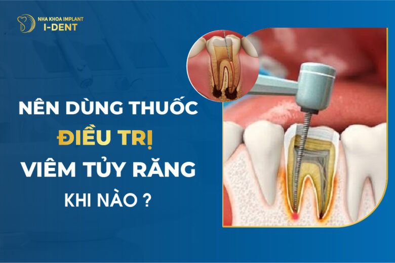 Nên Dùng Thuốc Điều Trị Viêm Tủy Răng Khi Nào?