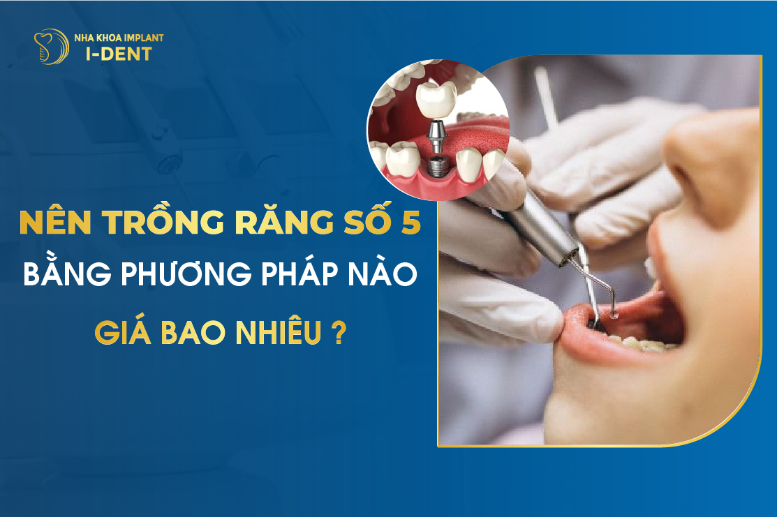 Nên trồng răng số 5 bằng phương pháp nào và giá bao nhiêu?