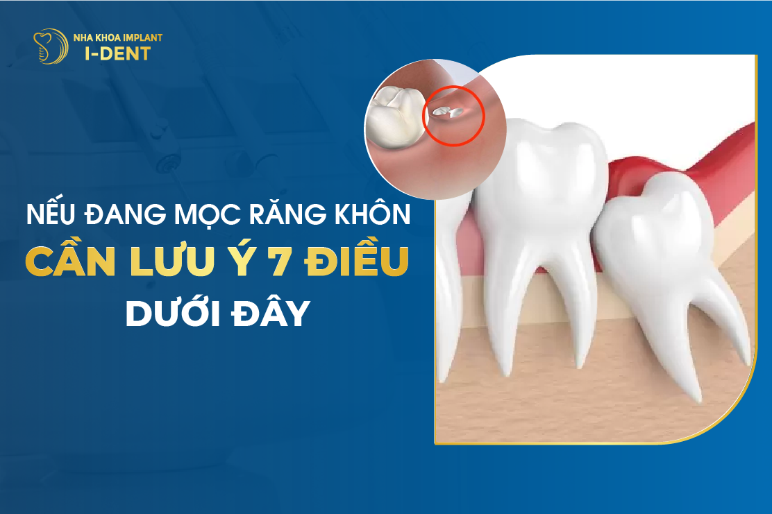 Mọc Răng Khôn Hàm Trên và Hàm Dưới Nên Làm Gì?
