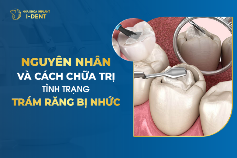 Nguyên Nhân Và Cách Điều Trị Tình Trạng Trám Răng Bị Nhức