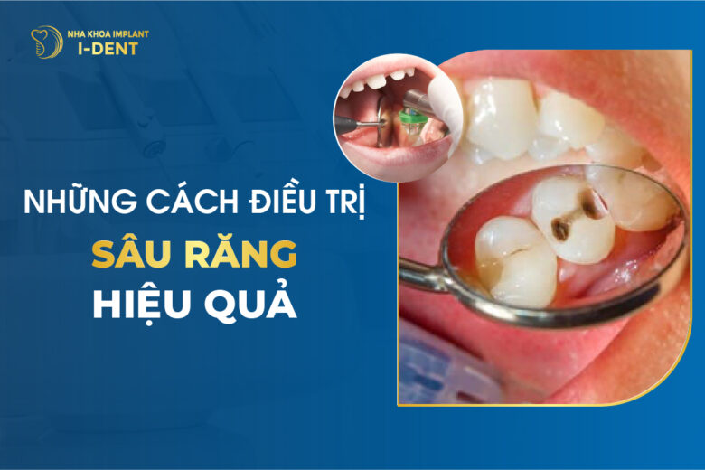 7 Cách trị sâu răng tại nhà hiệu quả nhanh chóng
