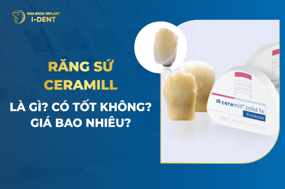 Răng Sứ Ceramill Có Tốt Không? Giá Bao Nhiêu?