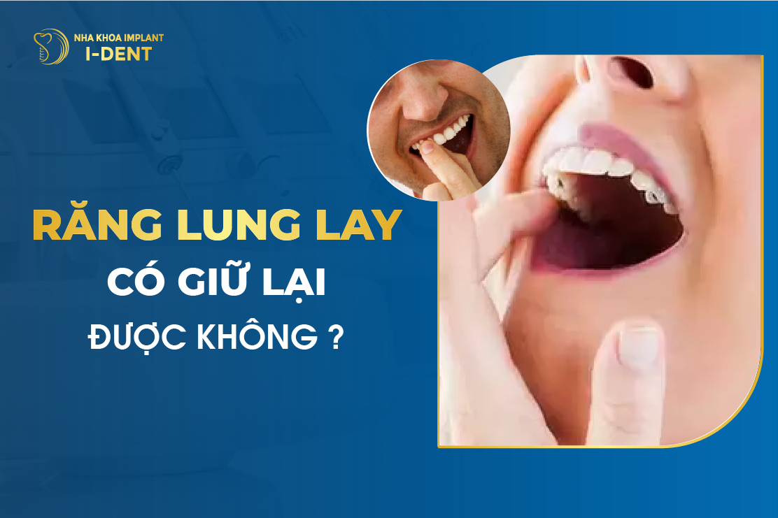 Răng lung lay: Nguyên nhân, biểu hiện và cách điều trị