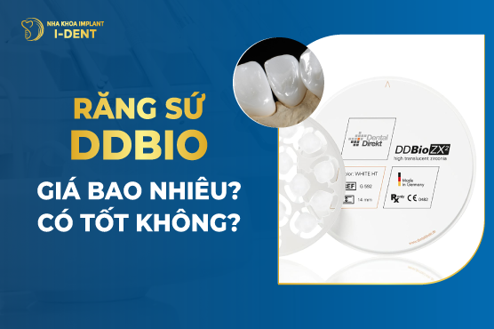Răng Sứ DDBio Giá Bao Nhiêu? Có Tốt Không?