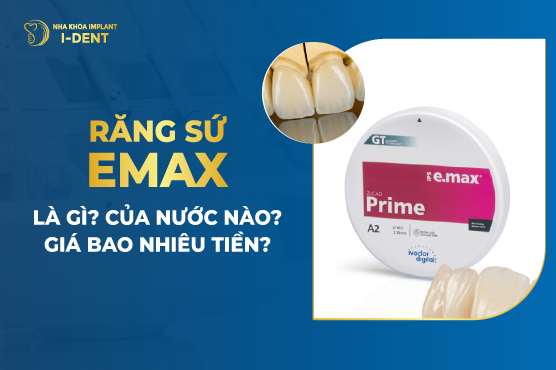 Răng Sứ Emax Là Gì? Của Nước Nào? Giá Bao Nhiêu Tiền?