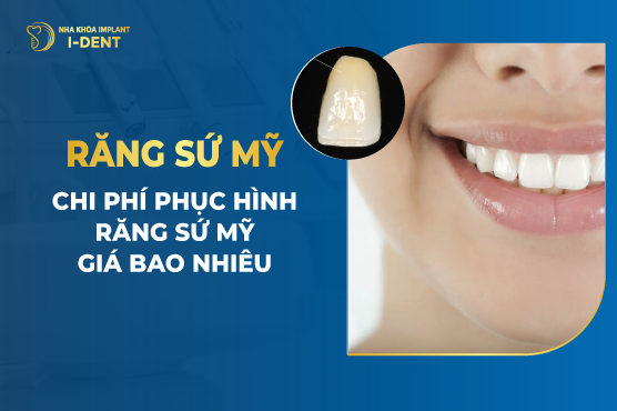 Răng Sứ Mỹ – Chi Phí Phục Hình Răng Sứ Mỹ Giá Bao Nhiêu