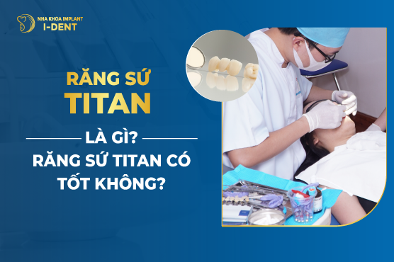 Răng Sứ Titan Là Gì? Có Tốt Không? Có Mấy Loại?