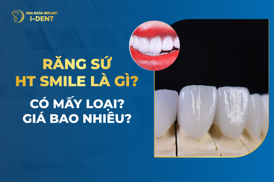 Răng Sứ HT Smile Có Mấy loại? Giá bao nhiêu tiền?