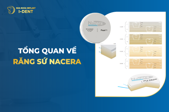 Tổng Quan Về Răng Sứ Nacera