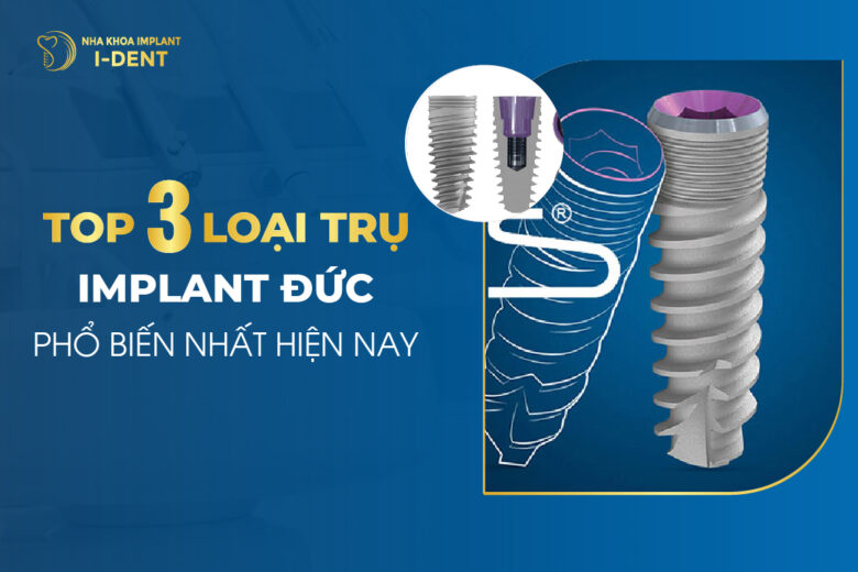 Top 3 Loại Trụ Implant Đức Phổ Biến Nhất Hiện Nay