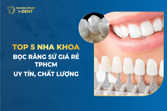Top 5 Nha Khoa Bọc Răng Sứ Giá Rẻ TPHCM Uy Tín, Chất Lượng