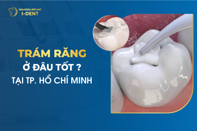 Trám Răng Ở Đâu Tốt TPHCM? Gợi Ý 9 Địa Chỉ Uy Tín Nhất Hiện Nay