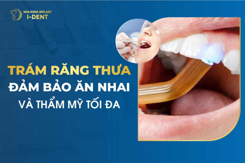 Trám Răng Thưa: Đảm Bảo Ăn Nhai Và Thẩm Mỹ Tối Đa