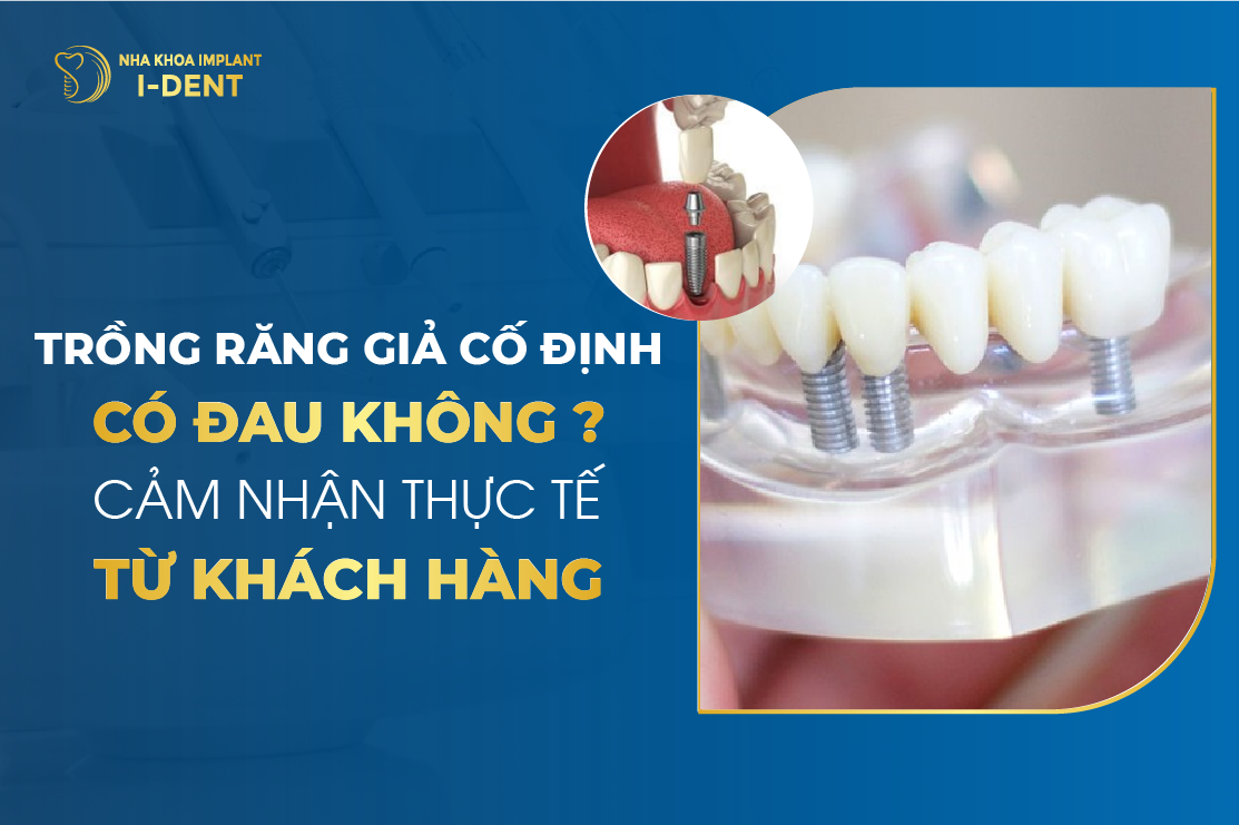 Trồng Răng Giả Cố Định Có Đau Không? Cảm Nhận Thực Tế Từ Khách Hàng