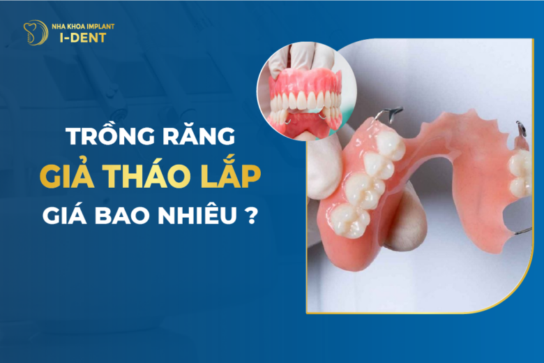 Trồng hàm răng giả tháo lắp: Ưu điểm, nhược điểm và chi phí