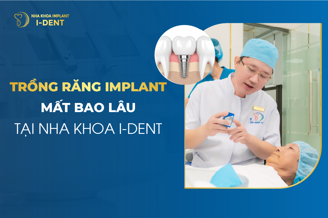 Trồng răng implant mất bao lâu? Quy trình chi tiết 3-6 tháng