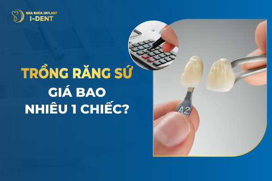 Trồng răng sứ giá bao nhiêu tiền 1 chiếc? Yếu tố ảnh hưởng giá