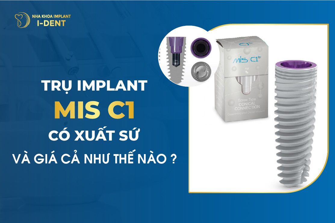 Trụ Implant Mis Có Xuất Xứ Và Giá Cả Như Thế Nào?