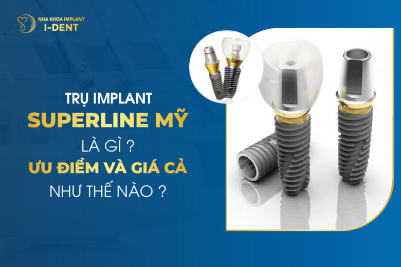 Trụ Implant Superline Mỹ Là Gì? Ưu Điểm Và Giá Cả Như Thế Nào?
