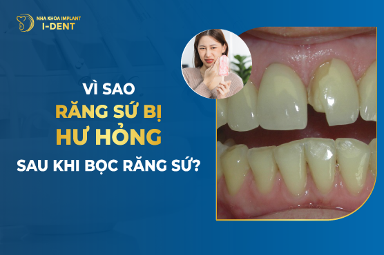 Vì Sao Răng Sứ Bị Hư Hỏng Sau Khi Bọc Răng Sứ?
