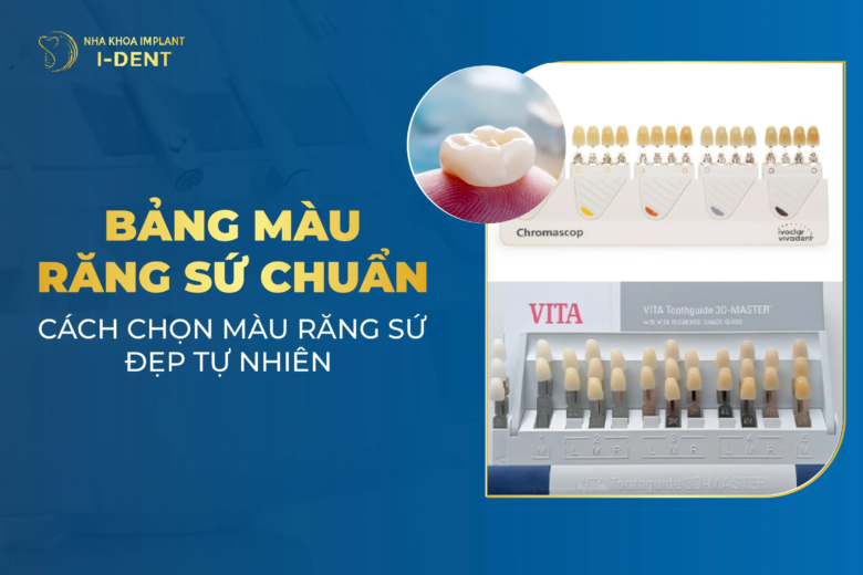 Bảng đo các tông màu của răng chuẩn và cách so màu