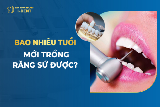 Bao Nhiêu Tuổi Mới Trồng Răng Sứ Được?