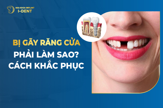 Bị Gãy Răng Cửa Phải Làm Sao? Cách Khắc Phục