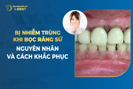 Bị Nhiễm Trùng Khi Bọc Răng Sứ: Nguyên Nhân Và Cách Khắc Phục