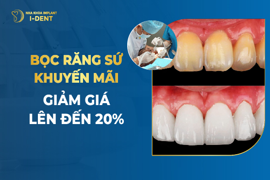 Bọc Răng Sứ Khuyến Mãi Giảm Giá Lên Đến 20%