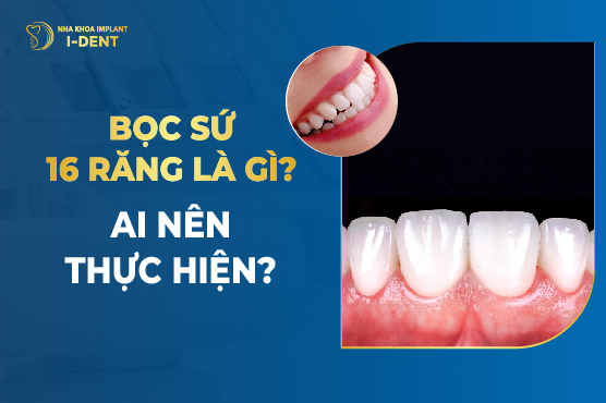 Bọc Sứ 16 Răng Là Gì? Ai Nên Thực Hiện?